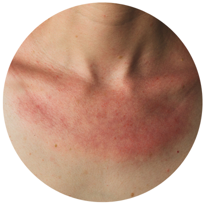 頭髮不明顯稀疏的人士