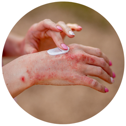 外塗及口服藥物