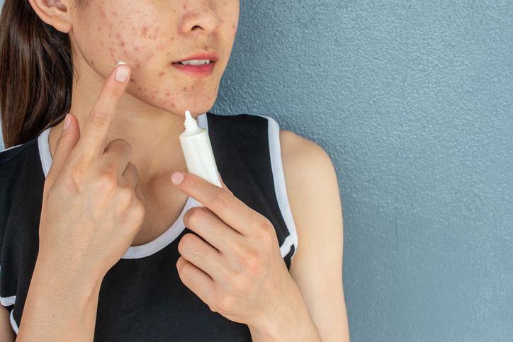 接近全禿的人士