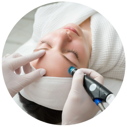 傳統納秒去暗瘡印激光