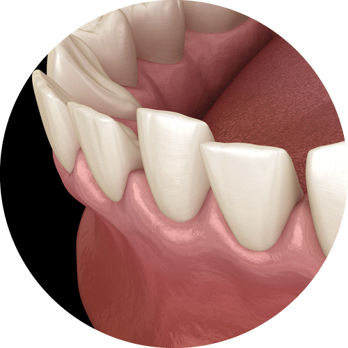 頭髮不明顯稀疏的人士