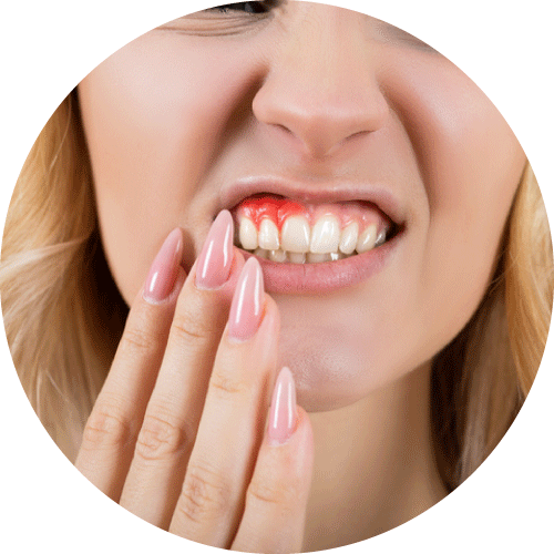 有蟹足腫體質的人士