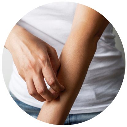 患有皮膚病的人士