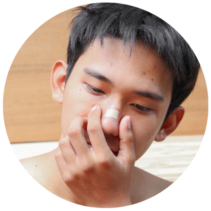 毛囊單位移植術 (FUT)