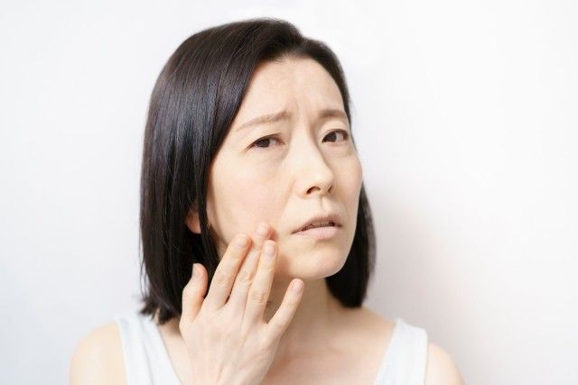 蘋果肌流失下垂