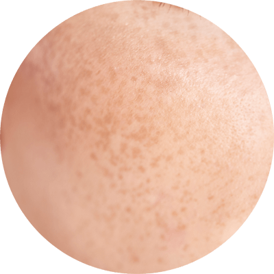 接近全禿的人士