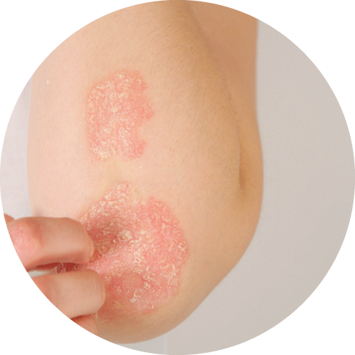 乳房皮膚有外傷