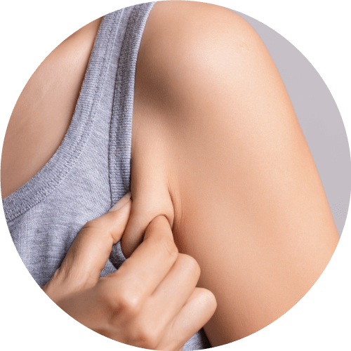 腋下擠出小肉團