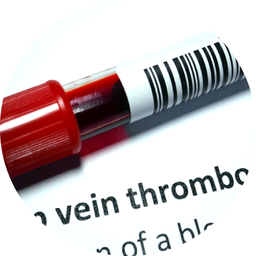 患有凝血機制障礙