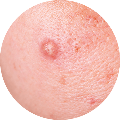 頭髮不明顯稀疏的人士