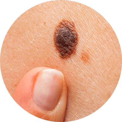 形容大小不一，觸感粗糙