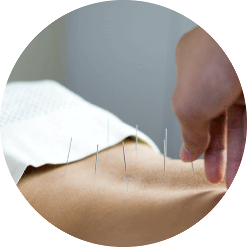 追求快速去暗瘡人士