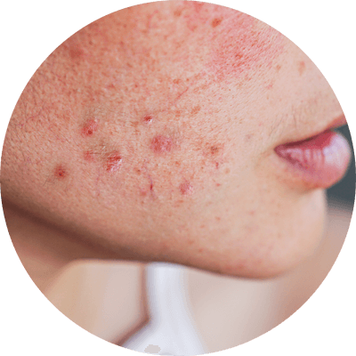 頭髮不明顯稀疏的人士