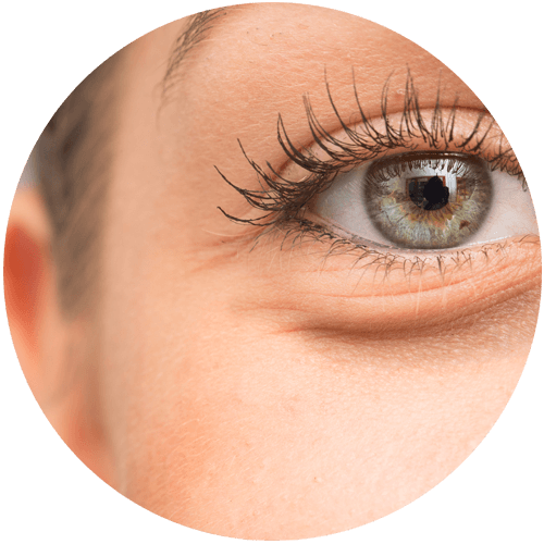 眼周皮膚缺乏彈性