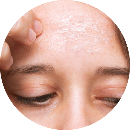 ARTAS植髮機械人