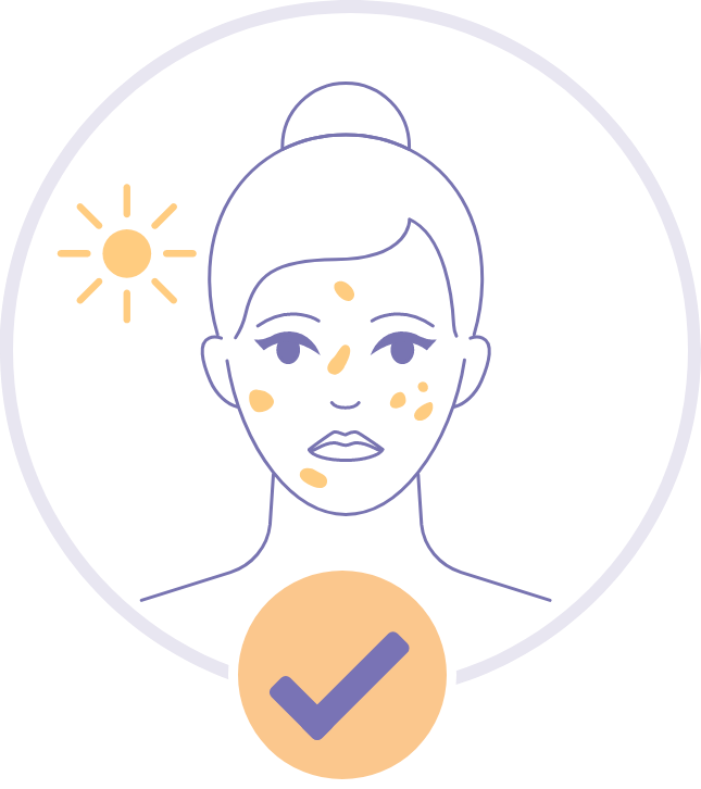 色斑越來越深色