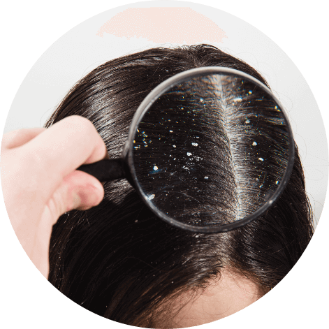 汗水油脂清潔不足