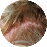 接近全禿的人士