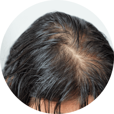 頭髮不明顯稀疏的人士